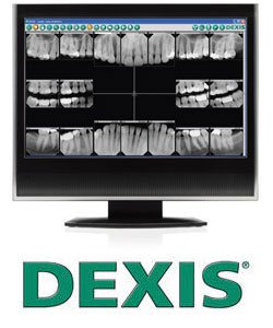 DEXIS digital x-rays on computer monitor